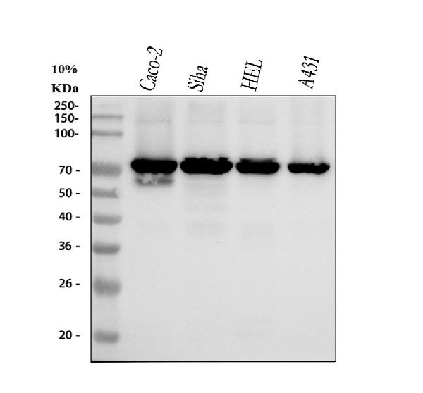 1 - Anti-p60 CAF1 Rabbit Monoclonal Antibody ABO15424
