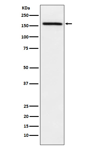 1 - Anti-ADAMTS13 Rabbit Monoclonal Antibody ABO15425