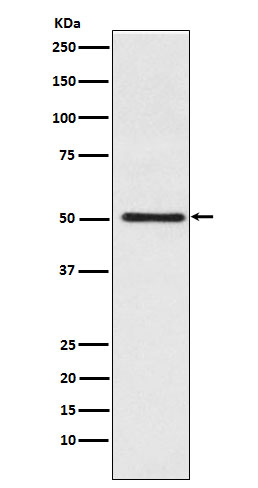 1 - Anti-Cytochrome P450 17A1 Rabbit Monoclonal Antibody ABO15426