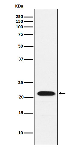 1 - Anti-CBFb Rabbit Monoclonal Antibody ABO15427