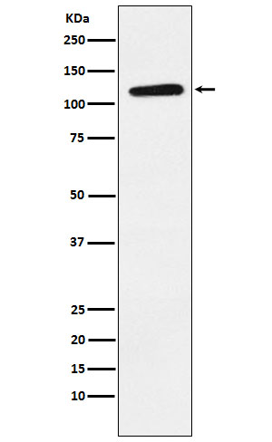 1 - Anti-Eph receptor B1 Rabbit Monoclonal Antibody ABO15429