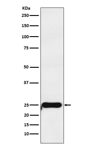 1 - Anti-COMT Rabbit Monoclonal Antibody ABO15430