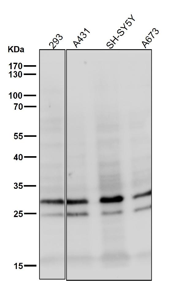 1 - Anti-COMT Rabbit Monoclonal Antibody ABO15430