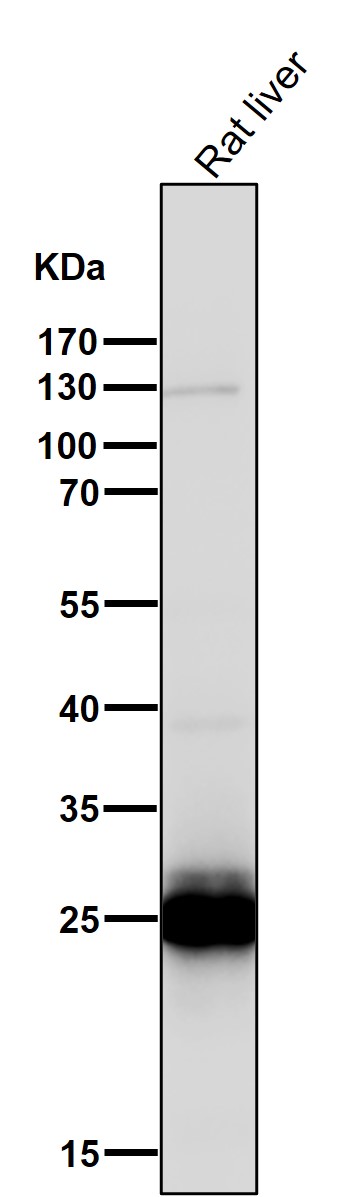 1 - Anti-COMT Rabbit Monoclonal Antibody ABO15430