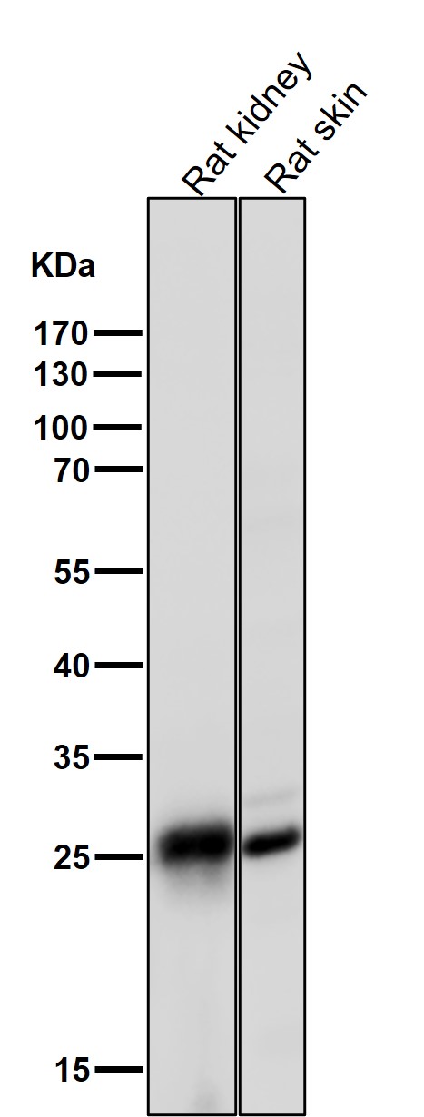 1 - Anti-COMT Rabbit Monoclonal Antibody ABO15430