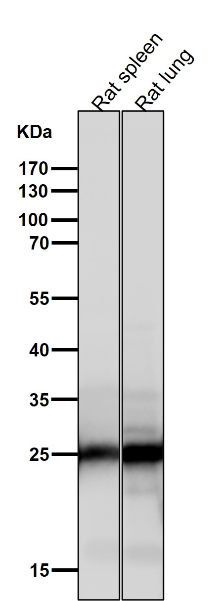 1 - Anti-COMT Rabbit Monoclonal Antibody ABO15430