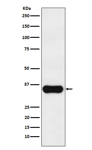 1 - Anti-MC1 Receptor Rabbit Monoclonal Antibody ABO15431