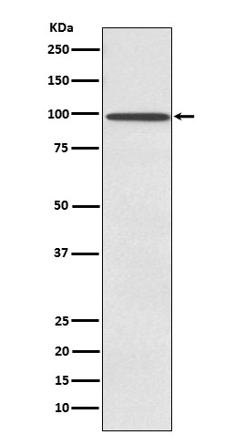 1 - Anti-SUN1 Rabbit Monoclonal Antibody ABO15433