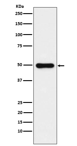 1 - Anti-Glutathione Synthetase Rabbit Monoclonal Antibody ABO15435