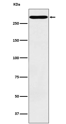 1 - Anti-CD35 Rabbit Monoclonal Antibody ABO15436