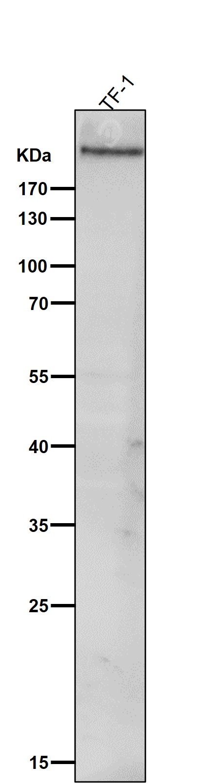 1 - Anti-CD35 Rabbit Monoclonal Antibody ABO15436