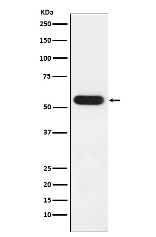 1 - Anti-FKBP52 Rabbit Monoclonal Antibody ABO15437