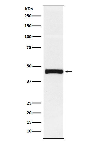 1 - Anti-Pentraxin 3 Rabbit Monoclonal Antibody ABO15438