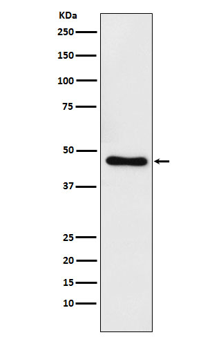 1 - Anti-CtBP1 Rabbit Monoclonal Antibody ABO15440