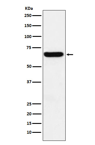 1 - Anti-Methionine Aminopeptidase 2 Rabbit Monoclonal Antibody ABO15441