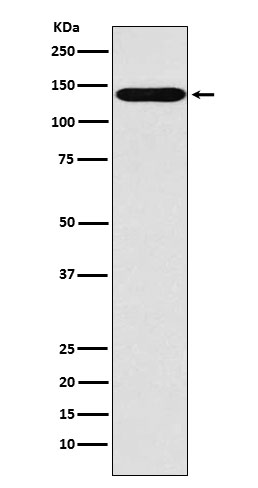 1 - Anti-SLC9A1 Rabbit Monoclonal Antibody ABO15444