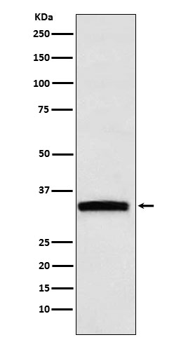1 - Anti-GDF15 Rabbit Monoclonal Antibody ABO15445