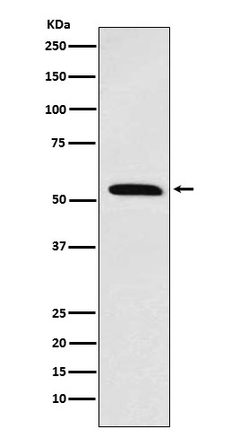 1 - Anti-Retinoid X Receptor alpha Rabbit Monoclonal Antibody ABO15447