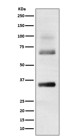1 - Anti-Loricrin Rabbit Monoclonal Antibody ABO15448