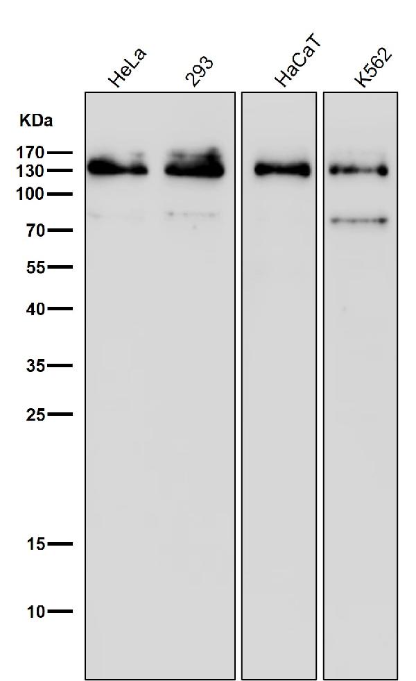 1 - Anti-MGEA5 Rabbit Monoclonal Antibody ABO15449