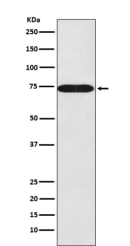 1 - Anti-SNX1 Rabbit Monoclonal Antibody ABO15450