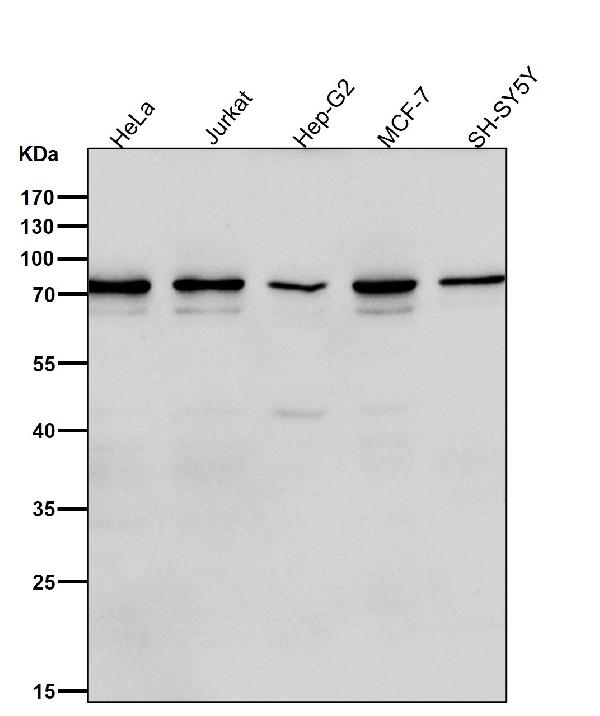 1 - Anti-Frizzled 8 Rabbit Monoclonal Antibody ABO15452