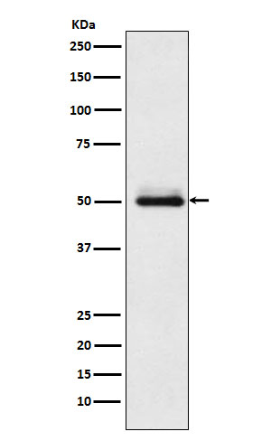 1 - Anti-Cytochrome P450 2C9 Rabbit Monoclonal Antibody ABO15454