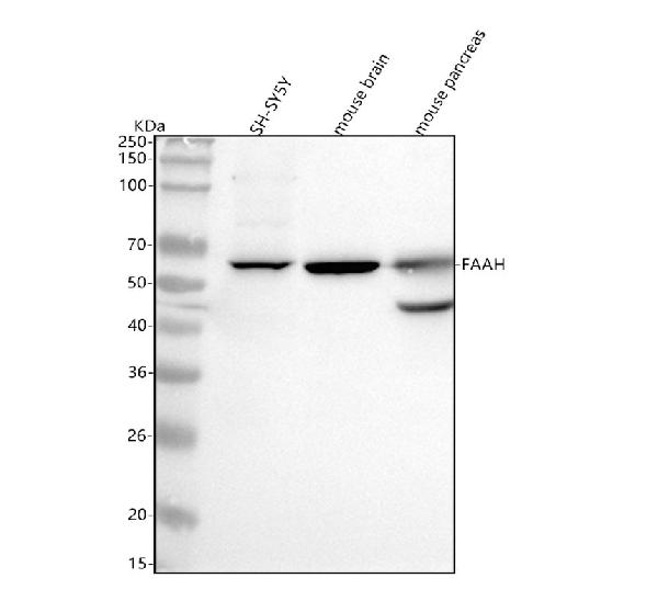 1 - Anti-FAAH1 Rabbit Monoclonal Antibody ABO15457