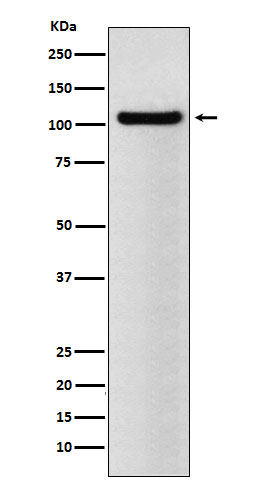 1 - Anti-BRD2 Rabbit Monoclonal Antibody ABO15458