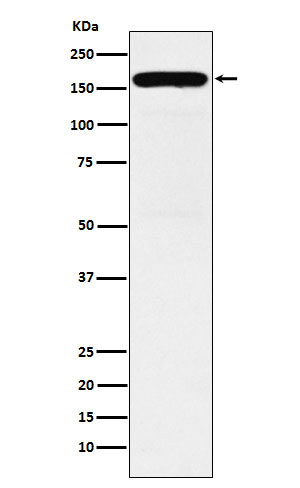 1 - Anti-DIAPH1 Rabbit Monoclonal Antibody ABO15463