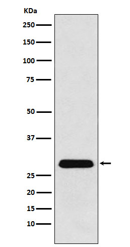 1 - Anti-PGAM1 Rabbit Monoclonal Antibody ABO15465