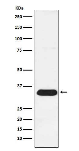 1 - Anti-Syntenin Rabbit Monoclonal Antibody ABO15466