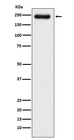 1 - Anti-Laminin gamma 1 Rabbit Monoclonal Antibody ABO15468