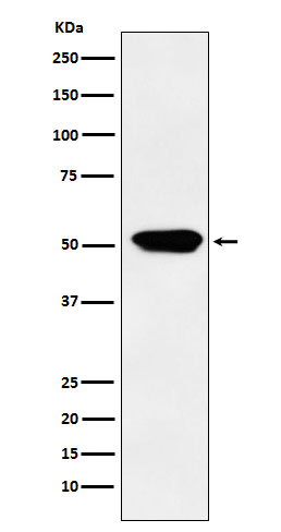 1 - Anti-Cytochrome P450 4A Rabbit Monoclonal Antibody ABO15469