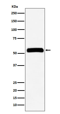 1 - Anti-IMPDH2 Rabbit Monoclonal Antibody ABO15471