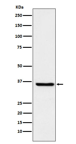 1 - Anti-GSTO1 Rabbit Monoclonal Antibody ABO15472