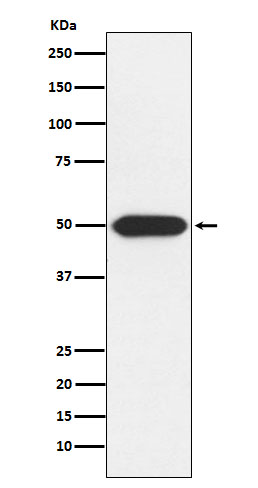 1 - Anti-PRKAR1A Rabbit Monoclonal Antibody ABO15475