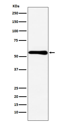 1 - Anti-CBS Rabbit Monoclonal Antibody ABO15479