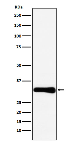 1 - Anti-Bcl10 Rabbit Monoclonal Antibody ABO15480