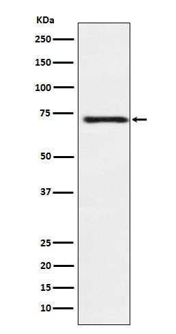 1 - Anti-Guanylyl Cyclase beta 1 Rabbit Monoclonal Antibody ABO15481