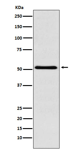 1 - Anti-BAF57/SMARCE1 Rabbit Monoclonal Antibody ABO15483