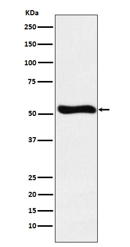 1 - Anti-Lumican Rabbit Monoclonal Antibody ABO15484