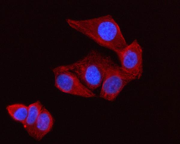 3 - Anti-Lumican Rabbit Monoclonal Antibody ABO15484