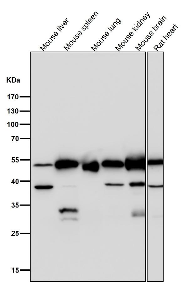 1 - Anti-Lumican Rabbit Monoclonal Antibody ABO15484