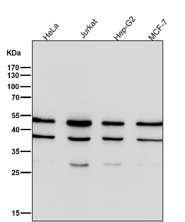 1 - Anti-Lumican Rabbit Monoclonal Antibody ABO15484