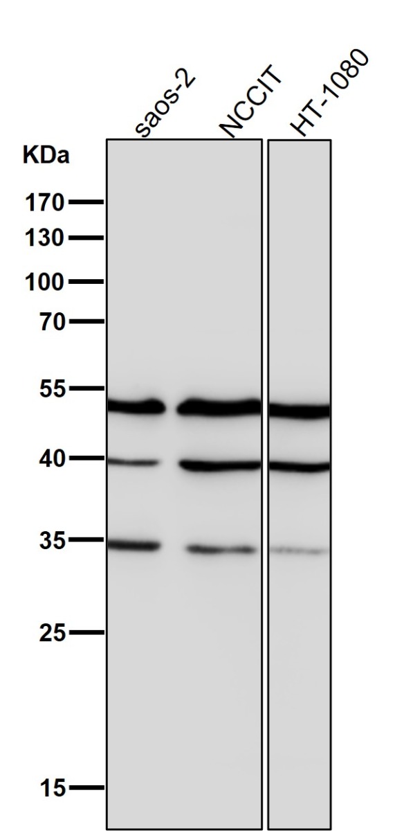 1 - Anti-Lumican Rabbit Monoclonal Antibody ABO15484