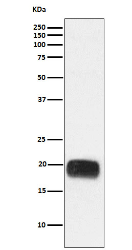 1 - Anti-Mammaglobin A Rabbit Monoclonal Antibody ABO15486