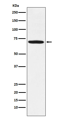 1 - Anti-LIMK1 Rabbit Monoclonal Antibody ABO15487