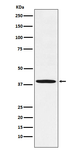 1 - Anti-Fbx32 Rabbit Monoclonal Antibody ABO15488