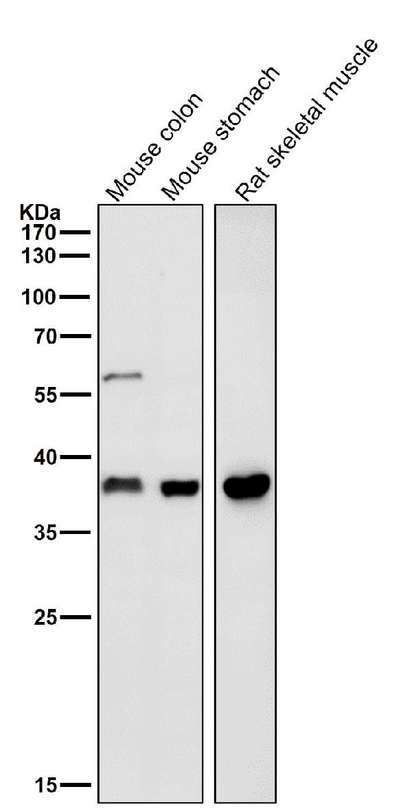 1 - Anti-Fbx32 Rabbit Monoclonal Antibody ABO15488